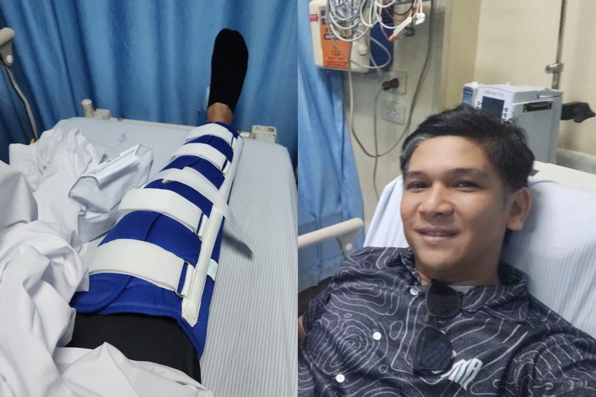 Mark Escueta suffers knee injury, fractured rib after bike accident 