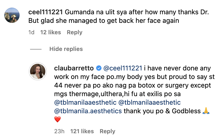 Claudine Barretto says she never underwent cosmetic surgery on face