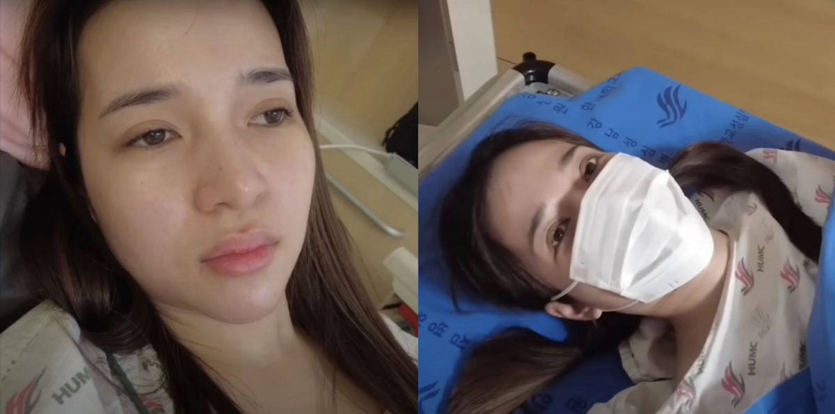 Kristel Fulgar shares emotional surgery journey due to rare tumor | Photo: Screengrab from KrisTells Vlogs/YouTube