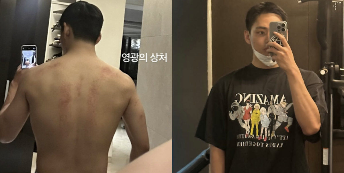 BTS’ V flaunts ‘injured back’ from extreme military training | Image: BTS' Weverse/Instagram, @thv