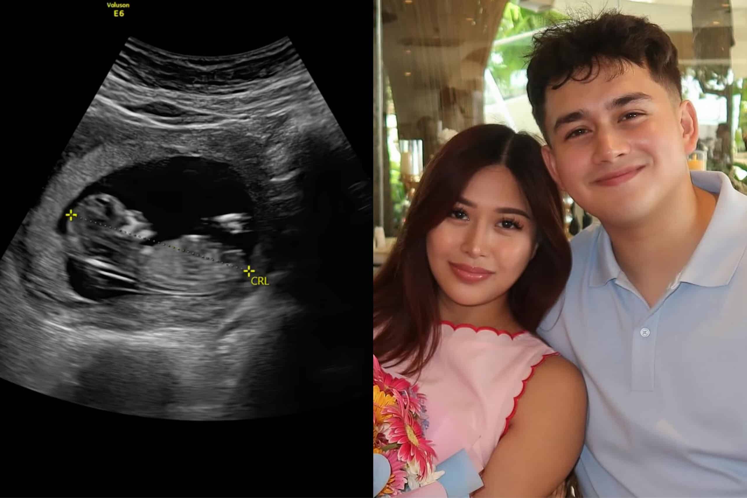 'PBB' alum Tan Roncal, partner mourns loss of first baby