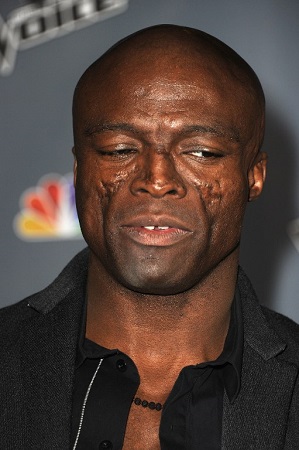 نجوم يعانون من "عاهات" لا تشكل عقدا لهم!